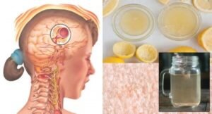 migrena-e1454596376468-1870213