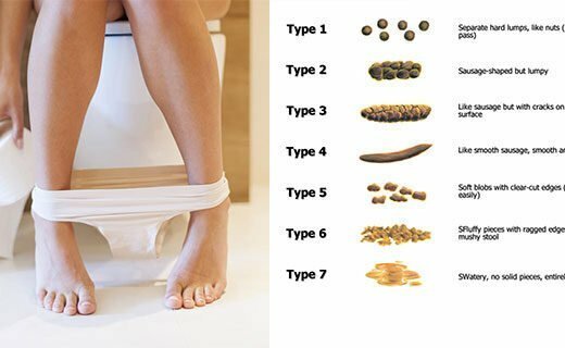 belco-520x320-6046054