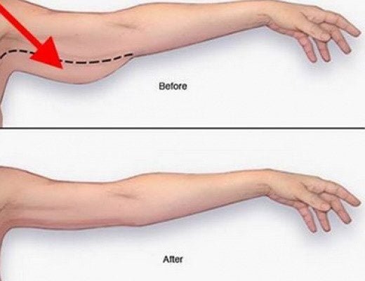 ruka-1-520x400-9811029