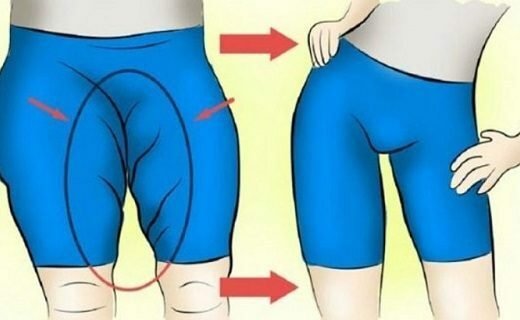 team-520x320-1817241