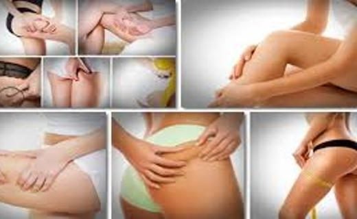 celulit-520x320-1133773