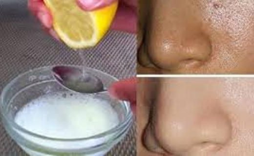 index-520x320-2902930