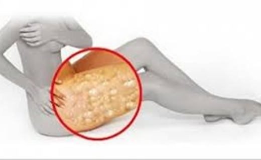 index-7-520x320-7319353