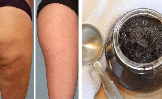 nova3-520x320-6128341