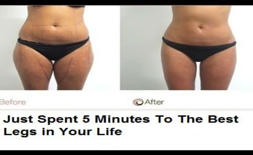 slika-1-19-520x320-9197206