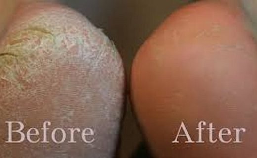 team-2-520x320-2181529