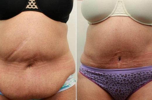 z-jpg-51-520x344-1209902