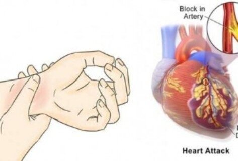 80-of-heart-attacks-could-be-avoided-if-everyone-did-these-5-easy-things-358x242-9229710