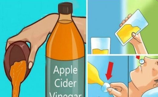 drink-apple-cider-vinegar-before-bed-because-you-will-treat-these-health-conditions-520x320-9030277