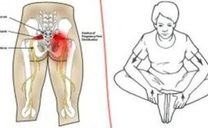 easy-exercises-to-lubricate-and-lose-the-muscles-on-your-back-and-hips-300x160-520x320-6971255