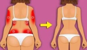 nackk-300x150-520x300-9157645