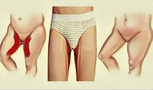 fffff-520x308-5442956