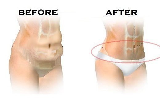 image0061-520x320-4819459