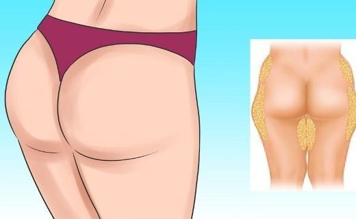 keep-520x320-9390766