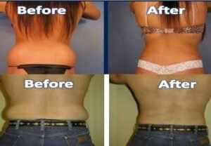 love-handles-520x360-3292755